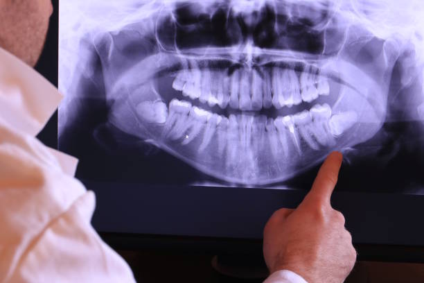 Best Emergency Denture Repair in Nottingham, PA