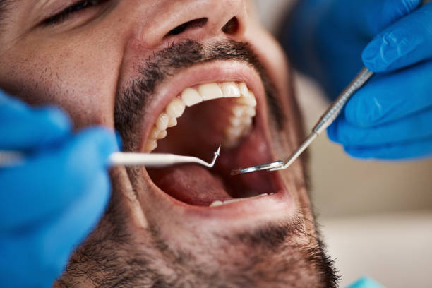 Best Dental Abscess Treatment in Nottingham, PA