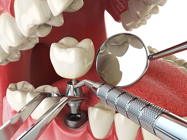 Best Emergency Treatment for Oral Infections in Nottingham, PA